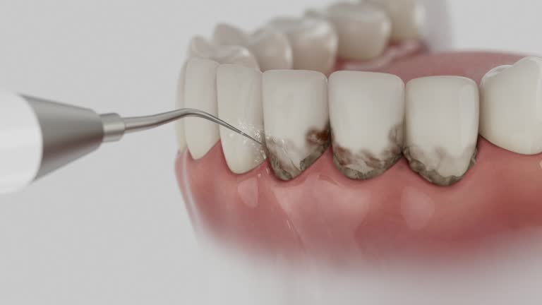 Reliable Dental contractor in Frisco, TX by Dentist Open Now